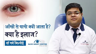 Do you know these facts about watery eyes ? | Symptoms, Causes & Treatment | Dr. Garv Bishnoi