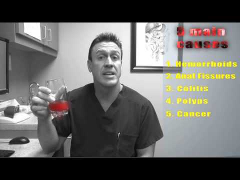 Red Blood in Stool - Causes and When to see a Doctor