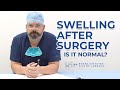 Swelling After Surgery - Is it Normal?