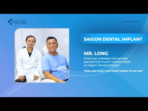 Experience of full-jaw implant implantation of Vietnamese abroad | Implant All on 6