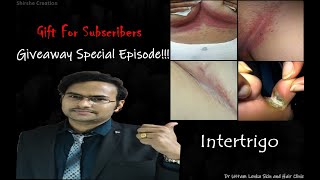 What is Intertrigo(infection of skin folds)?GIVEAWAY END!!