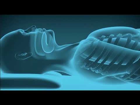Inspire® Upper Airway Stimulation: How It Works | BCH Sleep Medicine