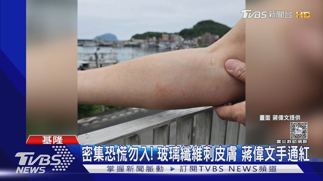 密集恐慌勿入！欄杆玻璃纖維刺皮膚　蔣偉文手通紅