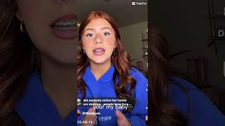 Download lagu why is everyone hating on her!? Did anyone notice her hands? #sky #lovelikejesus #hating mp3 Download lagu why is everyone hating on her!? Did anyone notice her hands? #sky #lovelikejesus #hating mp3