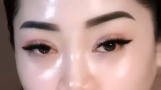 Download lagu Chronic spots are difficult to remove, don't use laser, apply this immediately mp3