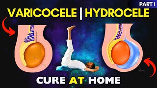Download lagu Part 1: Yoga to Heal Varicocele & Hydrocele at Home #varicocele #hydrocele mp3