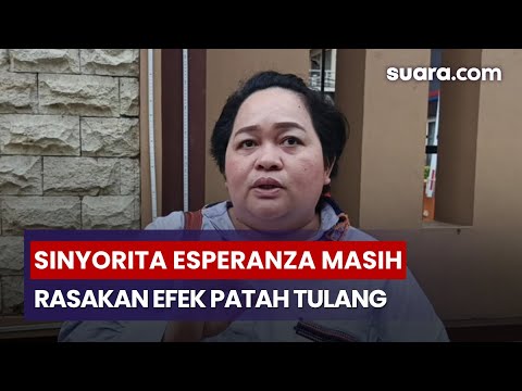 Efek Patah Tulang, Sinyorita Esperanza Masih Alami Nyeri Tiap Hujan dan Naik Pesawat