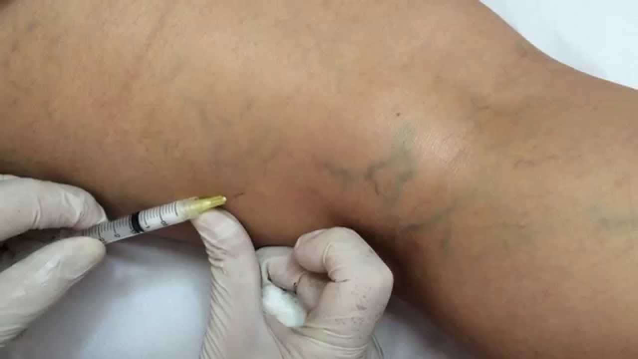 Itzi Peralta Martínez-1