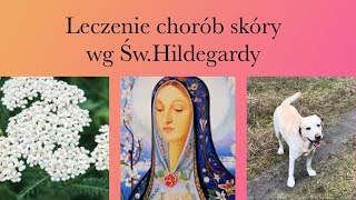 Leczenie chorób skóry ( w tym łuszczycy) wg Św.Hildegardy