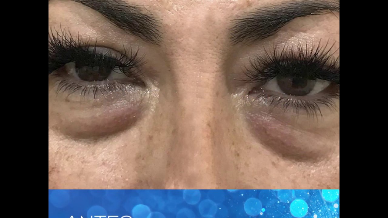 Juan Enrique Pérez Enríquez-166