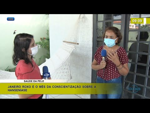 Janeiro Roxo é o mês de conscientização sobre a Hanseníase 08 01 2021