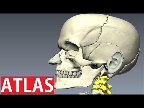 Wie starke Kopfschmerzen mit Osteochondrose entfernen Einige Schüsse mit starken Rückenschmerzen