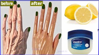 Remove hand wrinkles naturally with Vaseline remedy Wrinkled hands home remedy, wrinkle free hands