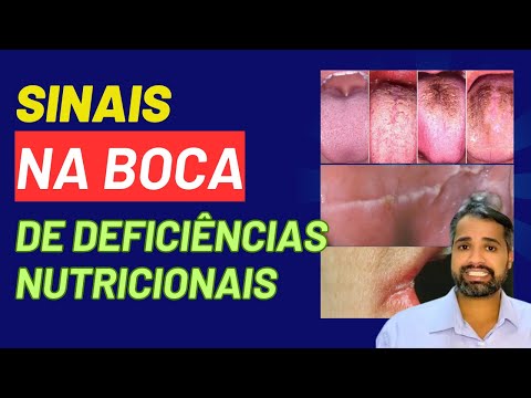 Francisco De Assis Almeida Lima Júnior-130
