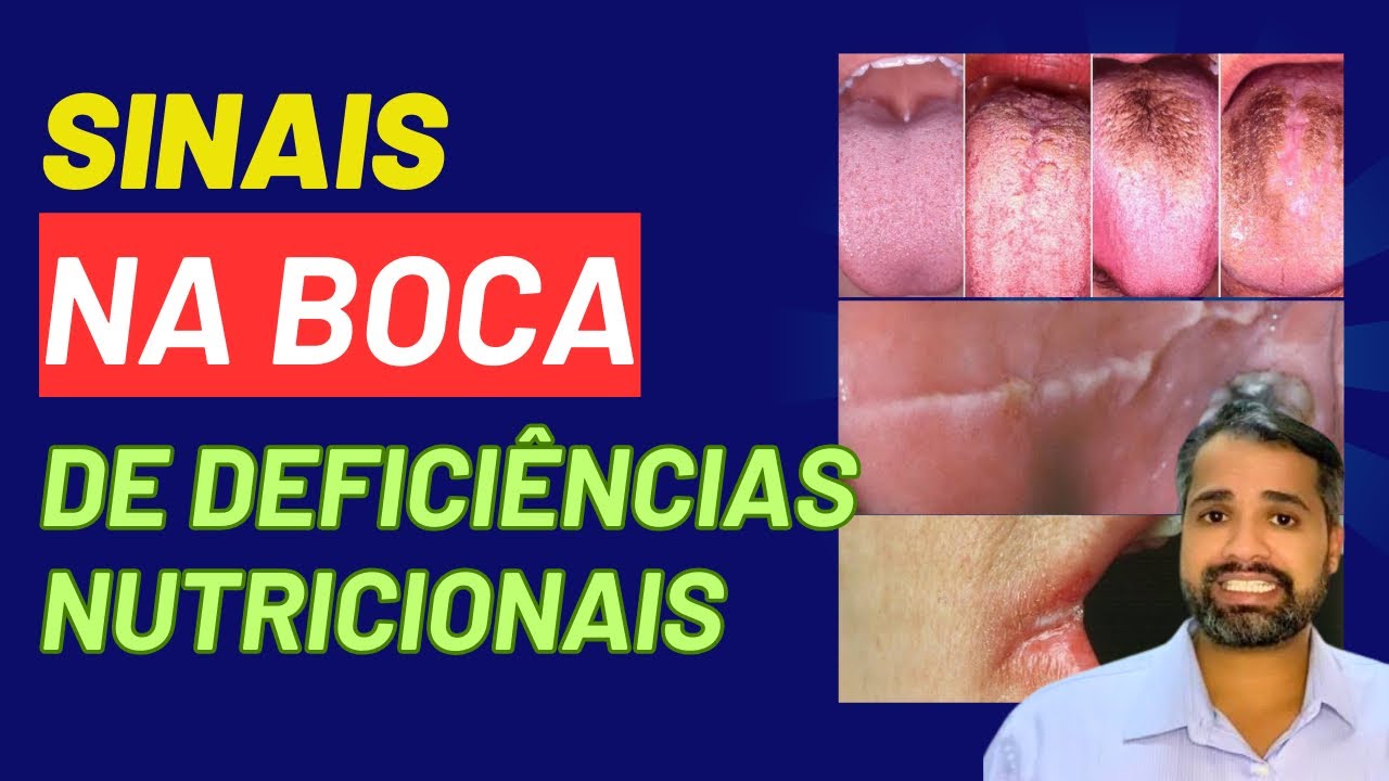 Francisco De Assis Almeida Lima Júnior-130