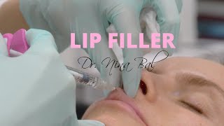 Lip Filler Procedure Before And After 💕 Natural Lip Fillers Before And After 💕 Dr Nina Bal