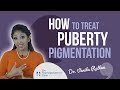 SKIN DOCTOR How To Treat HYPERPIGMENTATION From Puberty How To Fade Hyperpigmentation Fast