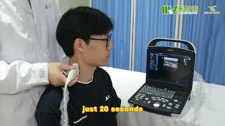 medsinglong Video of operating Mindray DP 10B ultrasound machine
