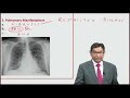 MRCP  | Systemic Sclerosis | Lectures by Dr Bhatia