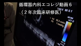 循環器内科エコレジ6/2年次臨床研修医/2021年7月15日