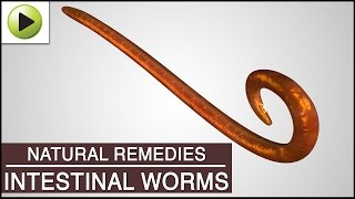 Intestinal Worms - Natural Ayurvedic Home Remedies