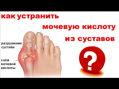 Когда болит и опух голеностопный сустав Боли в животе и пояснице при беременности на ранних