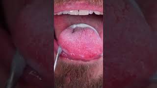 Do you remember to clean your tongue with a scraper? 😱🙈 #shorts