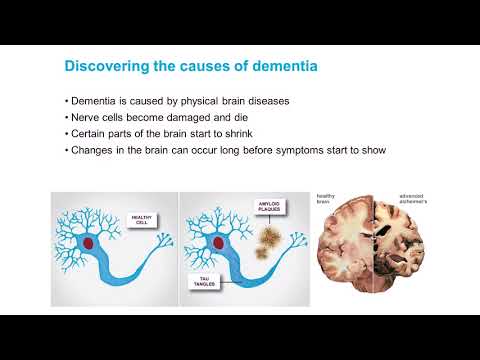 Why research holds the power to defeat dementia - Robin Brisbourne ARUK