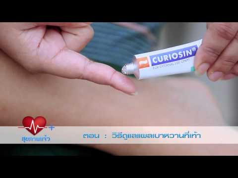 โรงพยาบาล Berdyansk โรคสะเก็ดเงิน กลากมีเส้นเลือดขอด