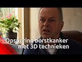 Dankzij Tom kan borstkanker via 3D-scan nog vroeger worden opgespoord