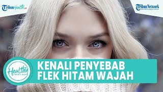 Kenali Sebab Flek Hitam di Wajah yang Kerap Disepelekan: Efek Samping Obat hingga Faktor Keturunan