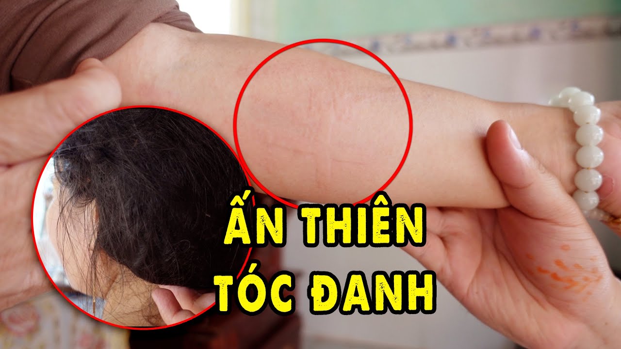 Tiên Cô Phong Ấn lên Da nên trên Tóc Đanh mọc Bắp Cải