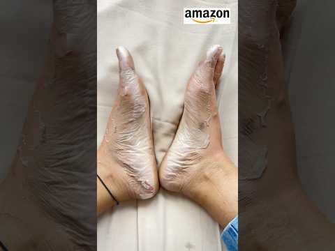 Foot peeling mask gone wrong😭#youtubeshort #trending #peeling #viralsong #amazonfinds #ytshorts #yt