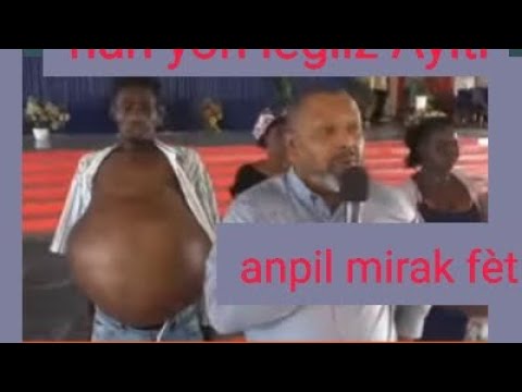 Malere paka fè rejim #pasteur #Marco#cherubin#amazing#comedies @onctiontv1@bòs_Mario_show