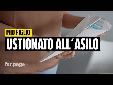 Bimbi ustionati all'asilo di Osio Sopra, una mamma: "Dopo un anno mio figlio non può stare al sole"