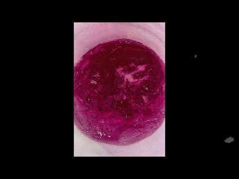 (FREE) Louie Ray x Yn Jay Type Beat "My story"