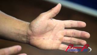 Numbness in Fingers &amp; Hand - Huntington Beach Chiropractor - Chiropractic Clinic Orange County