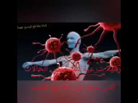 Dova za unistenje Sihira Uroka