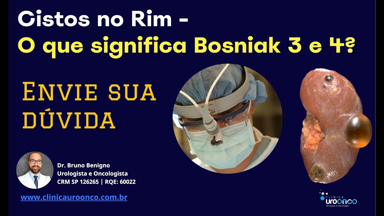 Quais os Risco do Cisto no Rim Bosniak 3 ou 4. Qual o melhor tratamento? Possível evitar a cirurgia?