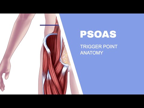 Psoas Trigger Points