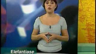 A 14 - Verminoses - Biologia - Vestibulando Digital