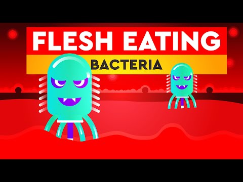 Flesh Eating Bacteria (Necrotizing fasciitis)