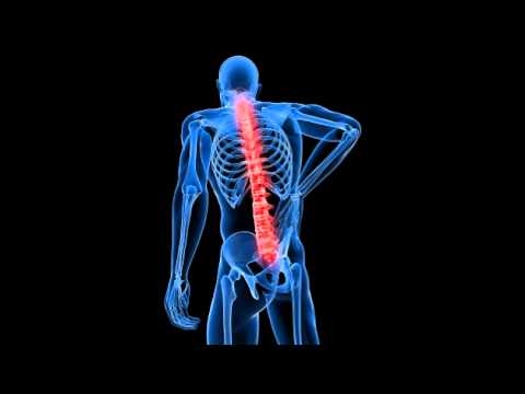 New Cure For BACK PAIN Using Antibiotics - Dr Hanne Albert
