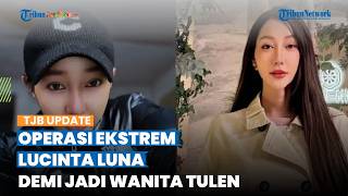 Tak Lagi Punya Sel Sperma, Deretan Operasi Lucinta Luna Demi Jadi Wanita, Sempat Ganti Kelamin