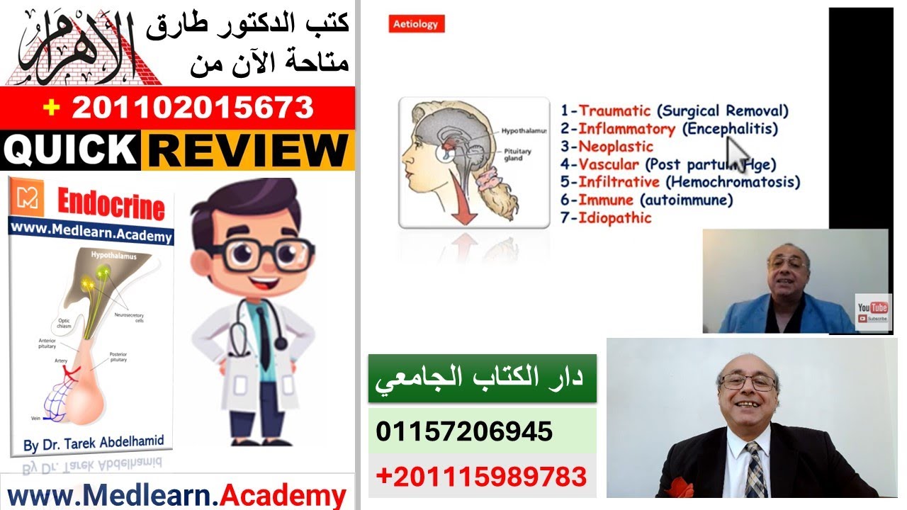 Panhypopituitarism  (Quick Review) #cme #internal_medicine #usmle #medicalstudent #محاضرات_باطنة