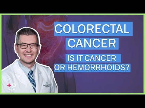 Colorectal Cancer - Is it Cancer or Hemorrhoids?