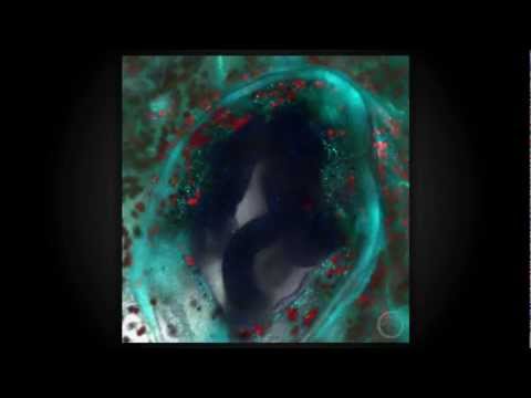 2012 Visualization Challenge: Observing the Coral Symbiome Using Laser Scanning Confocal Microscopy