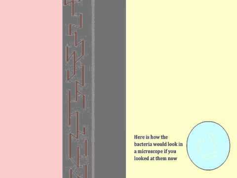 Staining of a Gram-Negative Bacterium - Multi-Lingual Captions