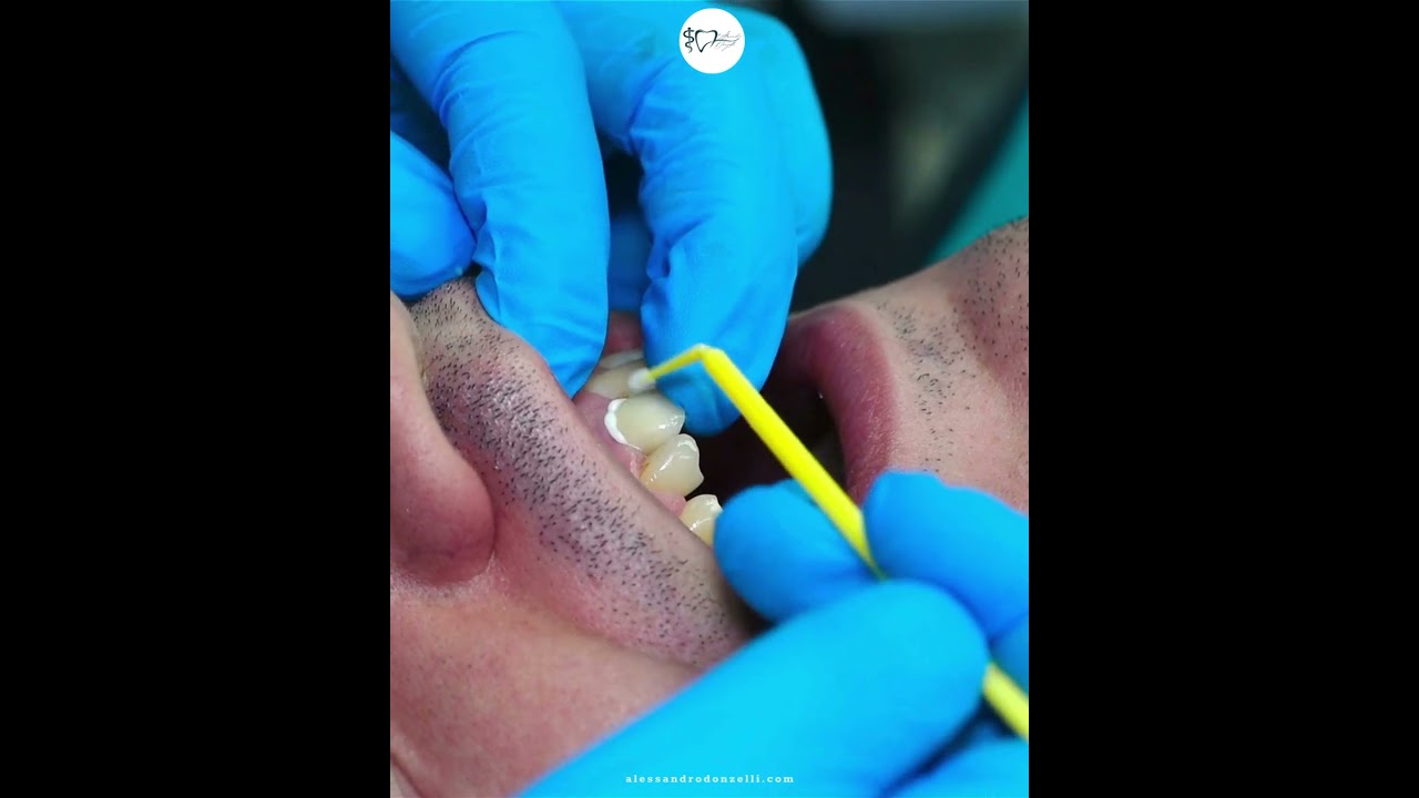 Alessandro Donzelli-21