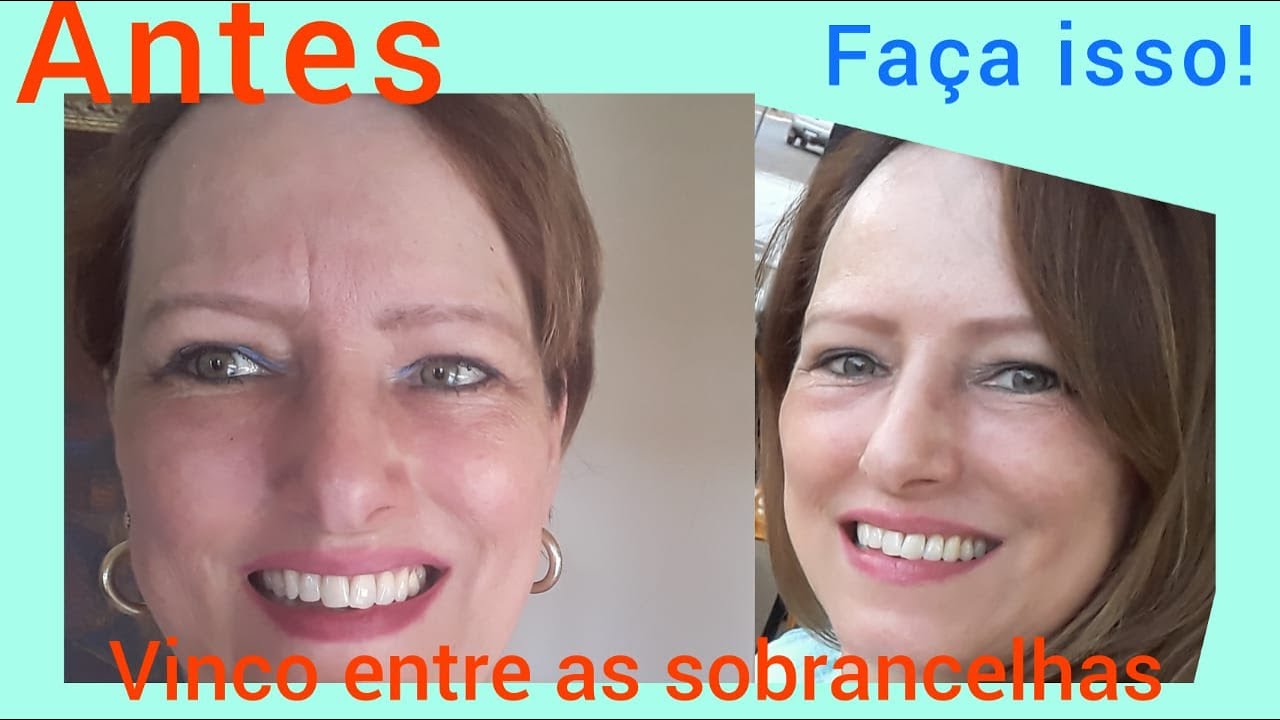 Acabe com o Vinco entre as sobrancelhas com Massagem Facial